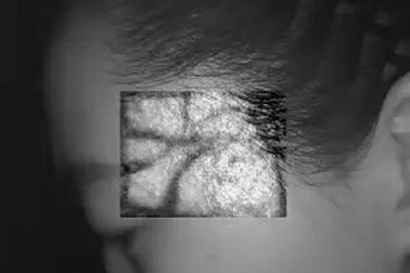 do hospital infravermelho do inventor da veia do Desktop da profundidade da imagem latente de 10mm equipamento médico