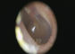 Otoscope video neutro Dermatoscope de Digitas da luz branca e câmera do Otoscope com alta resolução