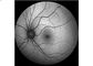 Equipamento oftálmico de Angiograph Digital 160° da retina
