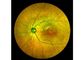 Equipamento oftálmico de Angiograph Digital 160° da retina