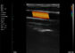 Echo Handheld Color Doppler Linear faz a varredura da frequência da artéria carotídea 7.5-10MHz